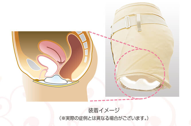 「フェミクッション」の装着イメージ