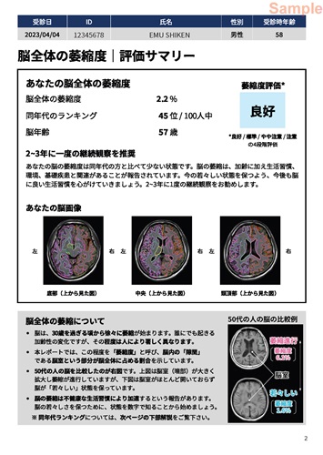 認知症の早期発見に挑むエム。AIが脳画像を分析