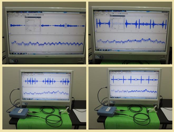 超音波プローブの超音波発振制御による非線形伝搬制御技術を開発