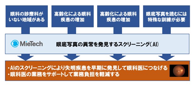 「眼底の疾患をスクリーニングするAI」の開発に着手