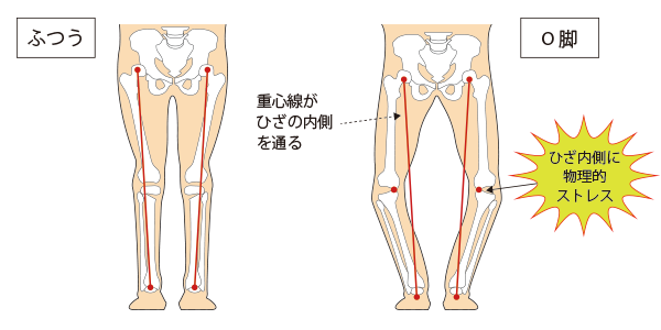 膝の痛みでお困りの方へ